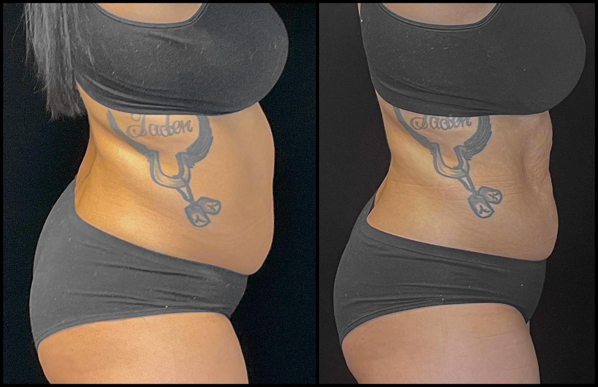 PüR Sculpt Body Shaping of Paducah